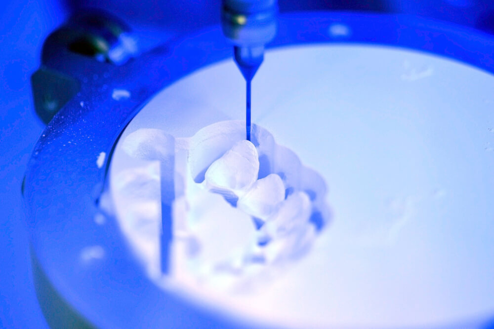 CAD CAM tehnologija u stomatologiji