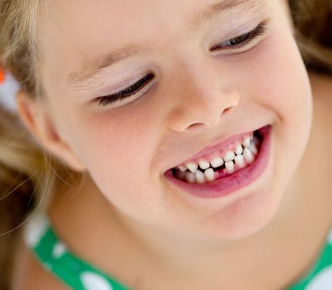 Mlečni zubi kod dece