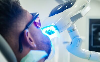 Ordinacijsko beljenje zuba