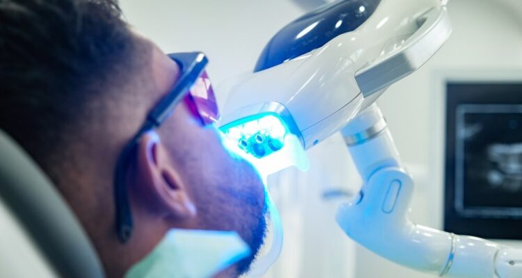 Ordinacijsko beljenje zuba