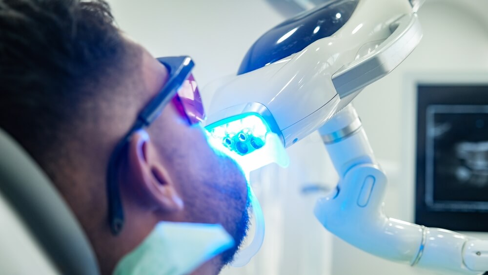 Ordinacijsko beljenje zuba